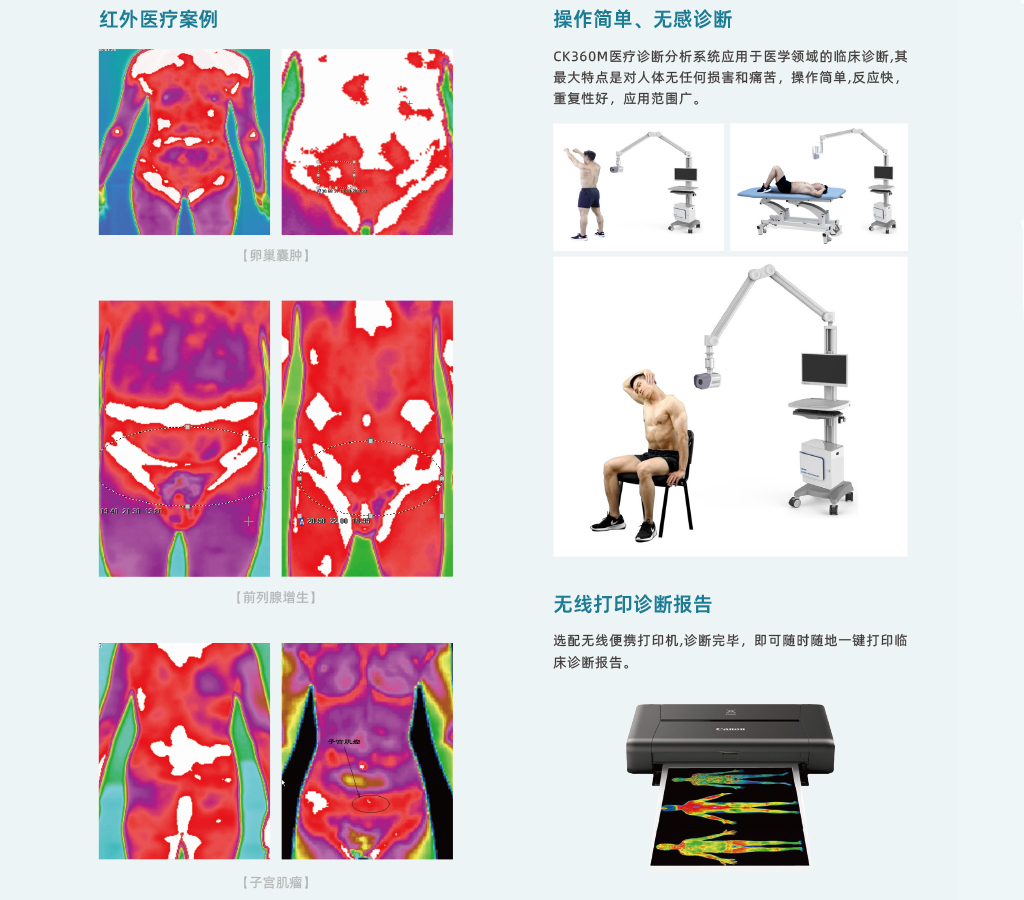 CK360-m醫(yī)療紅外熱像儀-颯特紅外4.jpg CK360-m醫(yī)療紅外熱像儀-颯特紅外4.jpg