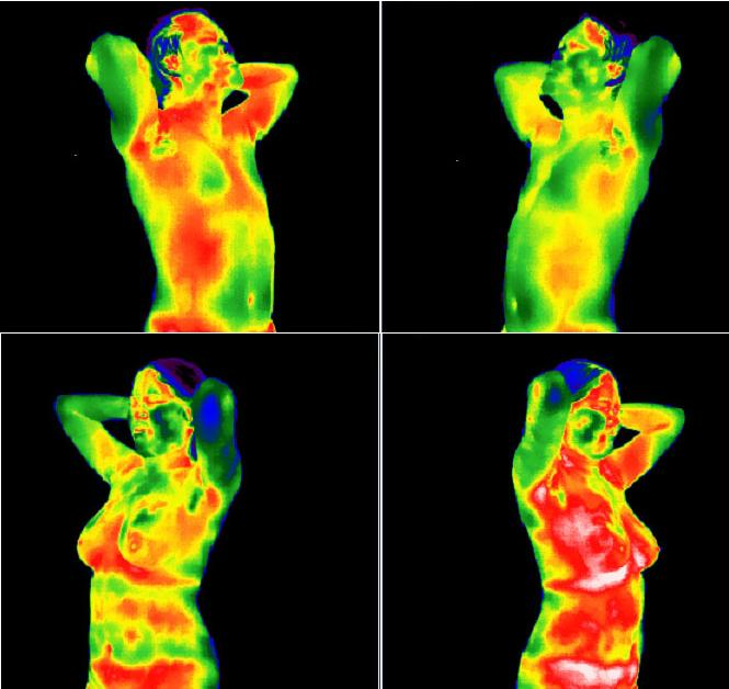 中醫紅外觀察：解碼人體熱像密碼，透視千億級健康產業新藍海